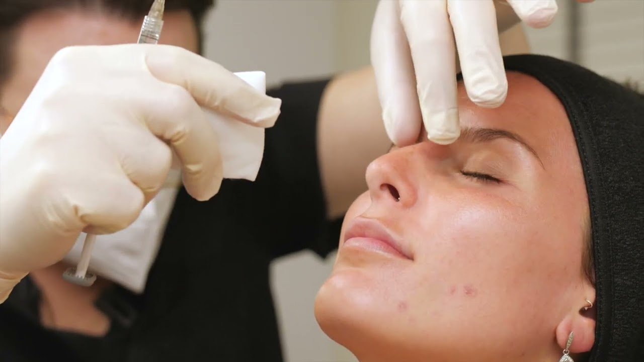 Nose Fillers in Islamabad: Recovery Time & Aftercare